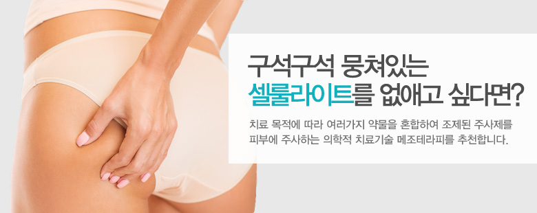 구석구석 뭉쳐있는 셀룰라이트를 없애고 싶다면?